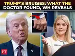 ‘Trump wanted transparency’: WH reveals shocking truth behind his swollen ankles & bruised hand